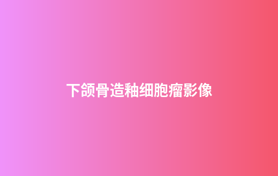 下颌骨造釉细胞瘤影像