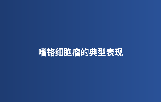 嗜铬细胞瘤的典型表现