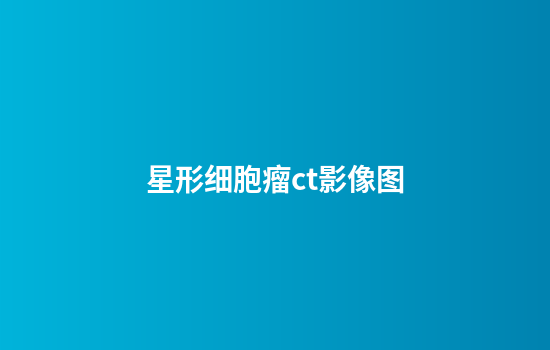 星形细胞瘤ct影像图